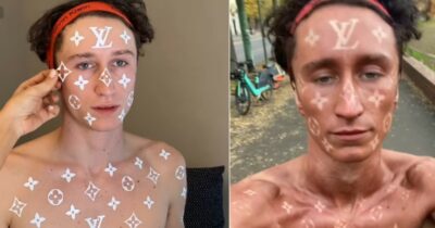 Copertina di “Ora la mia pelle è griffata Louis Vuitton”: l’assurdo tutorial per l’abbronzatura griffata diventa virale, ma è allarme per i rischi della tintarella estrema