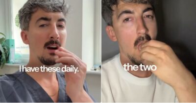 Copertina di “Shot di zenzero e curcuma al mattino, due kiwi prima di andare a letto”: i ‘segreti’ dell’esperto per una salute intestinale al top