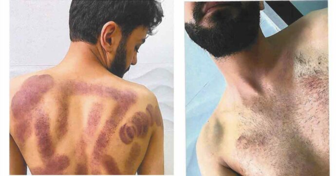 Un fantasma al Consolato di Erbil: torturato e scaricato da innocente