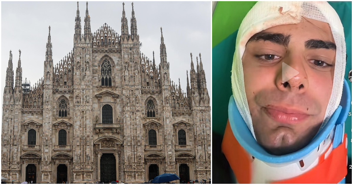 rapina a milano 25enne aggredito con un martello mi hanno spaccato la testa per un orologio di m8230