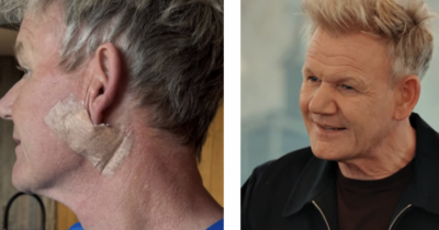 Copertina di “Ho scoperto un cancro alla pelle e sono stato operato. Giuro, non è un lifting!”: parla lo chef Gordon Ramsey