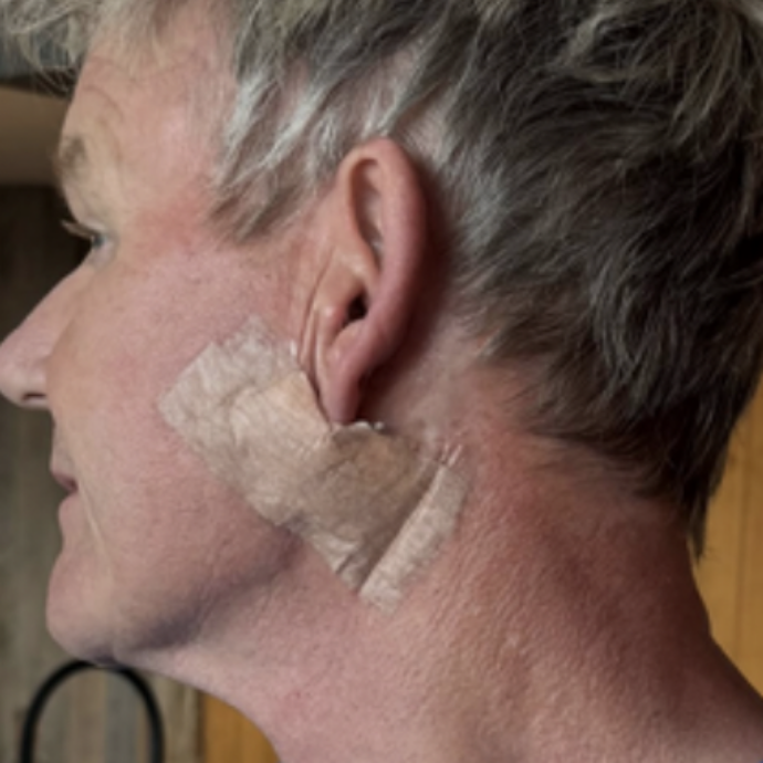 “Ho scoperto un cancro alla pelle e sono stato operato. Giuro, non è un lifting!”: parla lo chef Gordon Ramsey
