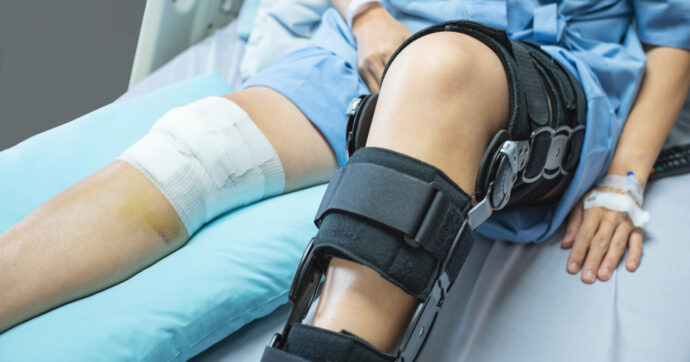 “Mi sono fatto rompere le ossa per allungare le gambe, così finalmente sono diventato più alto di mia moglie”: la storia di Frank e come funziona questa delicata operazione