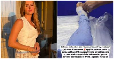 Copertina di Valentina Ferragni si fa “ingessare” le gambe: “Drena i liquidi e lascia un senso di leggerezza estrema”. Cos’è e come funziona la calcoterapia
