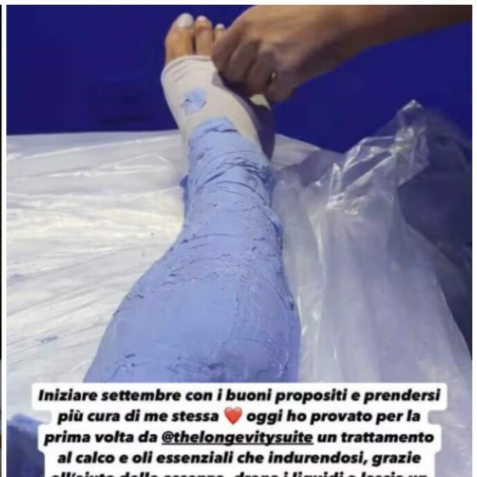 Valentina Ferragni si fa “ingessare” le gambe: “Drena i liquidi e lascia un senso di leggerezza estrema”. Cos’è e come funziona la calcoterapia