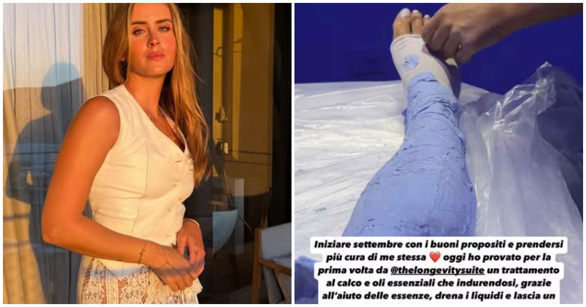 valentina ferragni si fa ingessare le gambe drena i liquidi e lascia un senso di leggerezza estrema cos8217232 e come funziona la calcoterapia