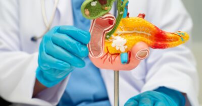 Copertina di Giornata Mondiale del Tumore al Pancreas, Rivizzigno: “Dieci anni fa era un buco nero. Oggi il tasso di sopravvivenza è al 13%, ma servono ospedali specializzati”