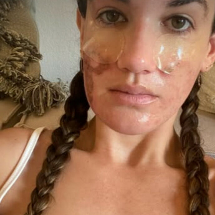 “L’estetista di Jennifer Lopez mi ha rovinato la pelle. Mi ha fatto spendere 30mila dollari e ho ustioni e cicatrici permanenti”: la storia di Victoria Nelson