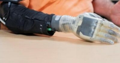 Copertina di La mano bionica e il senso del tatto, negli Usa sperimentazione su per 12 amputati