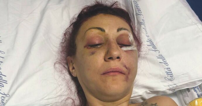 Marito violento giustificato: la Procura impugna sentenza