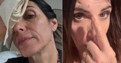 Copertina di Giorgia con una ferita sulla fronte ai Tim Music Awards: ecco cosa è successo prima della diretta