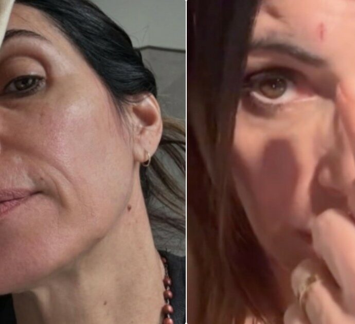 Giorgia con una ferita sulla fronte ai Tim Music Awards: ecco cosa è successo prima della diretta