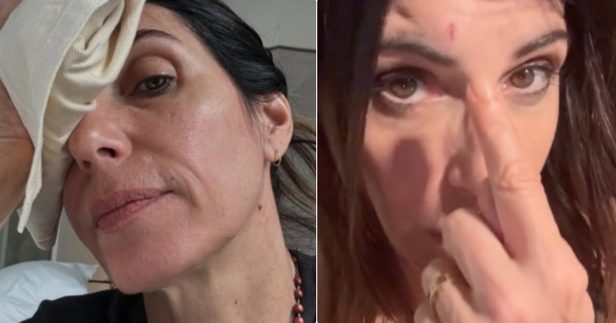 Giorgia con una ferita sulla fronte ai Tim Music Awards: ecco cosa è successo prima della diretta