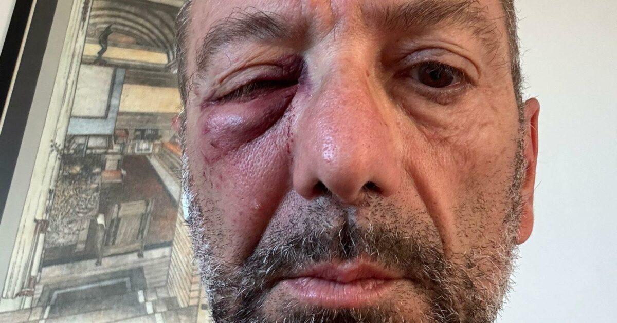 bari runner colpito in volto da un uovo lanciato da un8217auto non 232 un episodio isolato