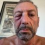 Copertina di Bari, runner colpito in volto da un uovo lanciato da un’auto: “Non è un episodio isolato”