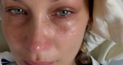 Copertina di “Scusate se sparisco sempre, sono in missione”: Bella Hadid ricoverata in ospedale, le foto con le flebo e le trasfusioni per la malattia di Lyme