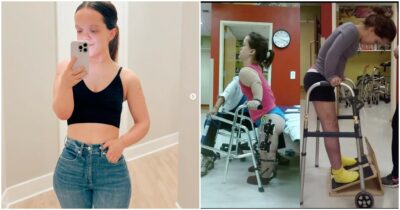 Copertina di “Non mi sono mai sentita nana, ma odiavo essere trattata come una cane da esposizione. Ora sono una ‘bassa comoda’”: la storia di Chandler Crews, che ha speso 2 milioni per farsi allungare gambe e braccia