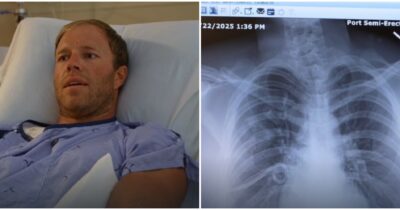 Copertina di “Ho pensato di morire, sono salvo per miracolo”: scalatore colpito da un masso grande quanto un microonde, viene operato d’urgenza