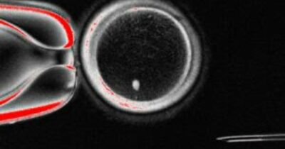 Copertina di “Ovuli fecondabili dalle cellule della pelle”, lo studio su Nature. Gli scienziati: “Concetto sperimentale contro l’infertilità”