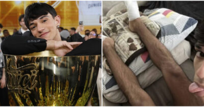 Copertina di “Avevo gli alluci incarniti. È arrivato un intervento spuntato all’improvviso”: così il ballerino e vincitore di Amici 24 Daniele Doria tranquillizza i fan