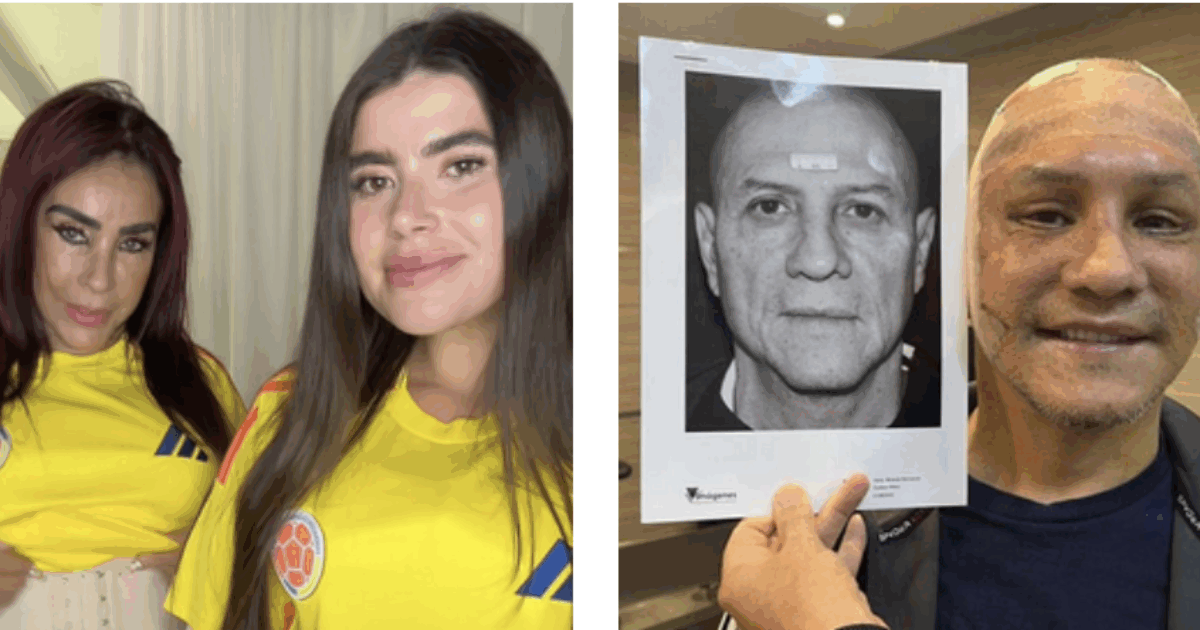 Influencer porta mamma, papà, zio e zia a fare interventi di chirurgia estetica tutti insieme per 63mila euro di spesa. Lo zio: “Mi dicono che sembro mio figlio, mi sento sexy”