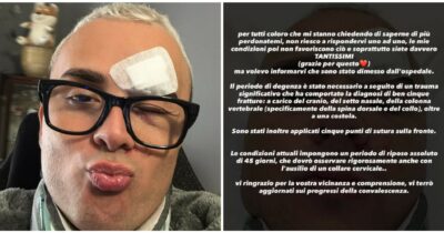 Copertina di “Sto bene a parte qualche punto in fronte”: l’influencer Mariano Prank riappare sui social dopo l’incidente stradale