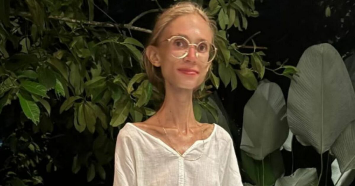 Influencer si trasferisce a Bali e mangia solo frutta per 10 mesi: “È morta che pesava 22 chili, non riusciva neanche a girarsi nel letto”. La rabbia dei genitori: “Plagiata dai vegani e dai social”