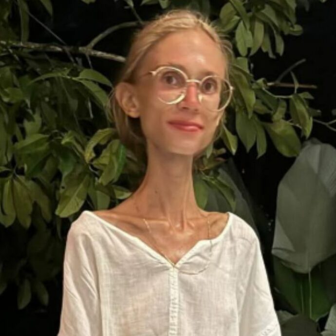 Influencer si trasferisce a Bali e mangia solo frutta per 10 mesi: “È morta che pesava 22 chili, non riusciva neanche a girarsi nel letto”. La rabbia dei genitori: “Plagiata dai vegani e dai social”