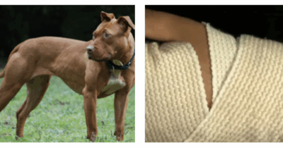 Copertina di “Un pitbull senza guinzaglio ha attaccato mia figlia, sono riuscita ad afferrarla ma lui allora mi ha morso la mano”: il drammatico assalto e la decisione di sopprimere il cane