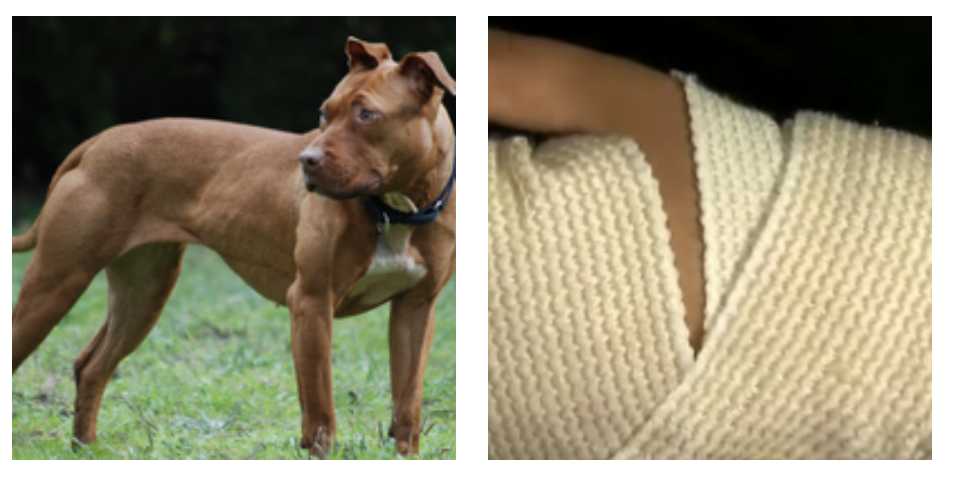 “Un pitbull senza guinzaglio ha attaccato mia figlia, sono riuscita ad afferrarla ma lui allora mi ha morso la mano”: il drammatico assalto e la decisione di sopprimere il cane “Un pitbull senza guinzaglio ha attaccato mia figlia, sono riuscita ad afferrarla ma lui allora mi ha morso la mano”: il drammatico assalto e la decisione di sopprimere il cane