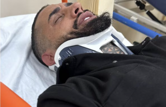 “Mi sono inca**ato come una bestia potevamo uccidere qualcuno. Ho avuto in incidente d’auto, guidava il mio amico poi il botto”: Francesco Chiofalo sull’incidente “Mi sono inca**ato come una bestia potevamo uccidere qualcuno. Ho avuto in incidente d’auto, guidava il mio amico poi il botto”: Francesco Chiofalo sull’incidente