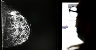 Copertina di Mammografie “dubbie” ma donne mai ricontattate: lo scandalo degli screening oncologici travolge l’Andalusia