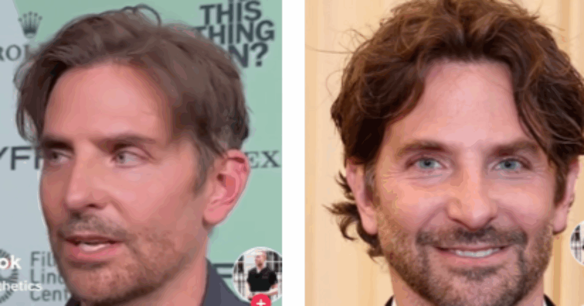 Che cosa è successo a Bradley Cooper? “Quello non è lui, è uno arrivato terzo a un concorso di suoi sosia”: la faccia dell’attore scatena i commentatori