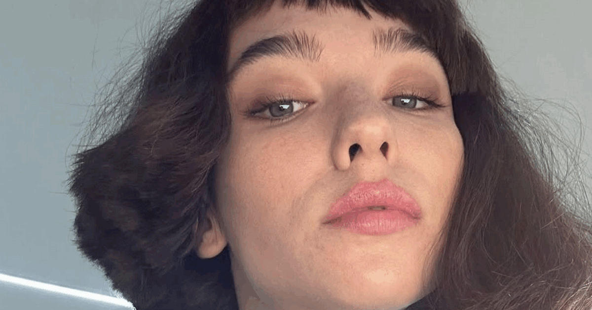 “La lite con Elodie? Le mie parole sono state travisate. A 23 anni non sono uscita di casa per svariati mesi, avevo l’acne, il corpo non mente”: parla Matilda De Angelis