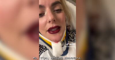Copertina di “Mi sono schiantata con la bici ma il mio rossetto è ancora perfetto”: il video della tiktoker dall’ospedale fa discutere