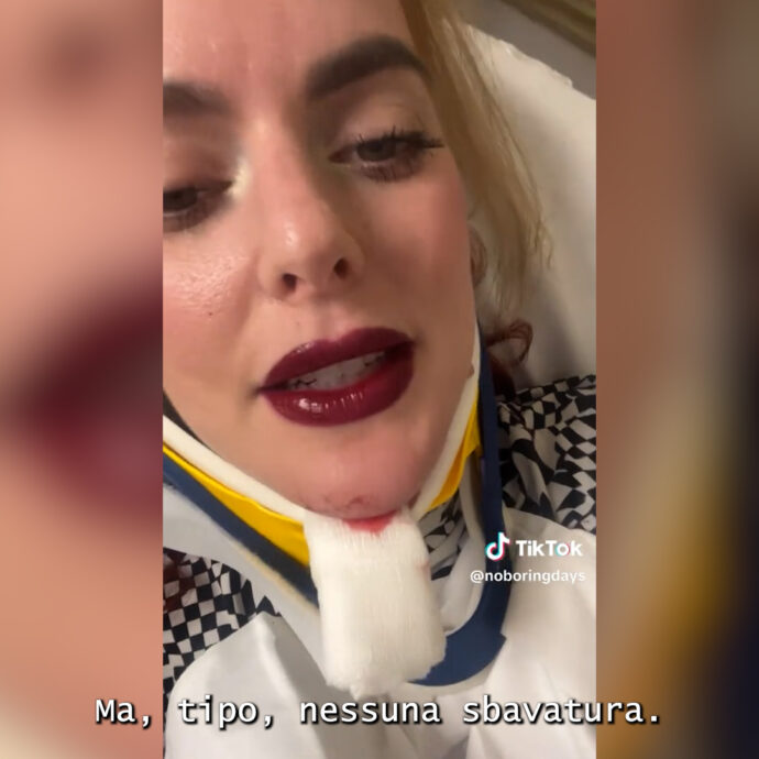 “Mi sono schiantata con la bici ma il mio rossetto è ancora perfetto”: il video della tiktoker dall’ospedale fa discutere