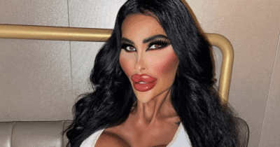 Copertina di “I medici mi hanno bloccata perché peso 45 kg. Ho speso 110mila euro in interventi di chirurgia per diventare una Barbie”: così Tara Jayne McConachy