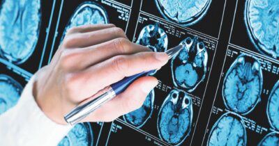 Copertina di Malati gravissimi, le Regioni si svegliano e chiedono più fondi