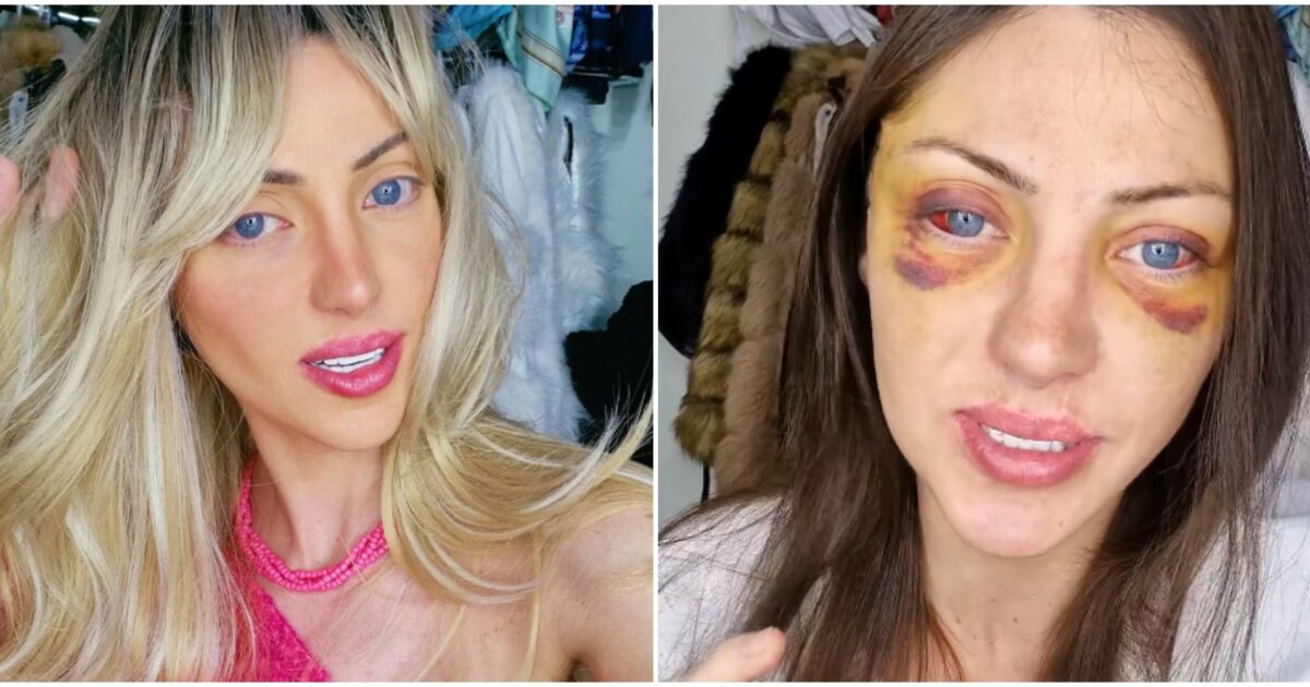 200 morta la barbie umana trovata in casa l8217influencer che si era sottoposta a 27 interventi per assomigliare alla celebre bambola si indaga sulle cause da Ilfattoquotidiano.it 200 morta la barbie umana trovata in casa l8217influencer che si era sottoposta a 27 interventi per assomigliare alla celebre bambola si indaga sulle cause