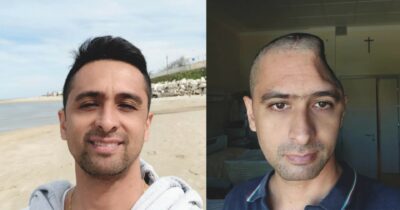 Copertina di “Ho perso un pezzo di testa, ma non vogliono credermi”