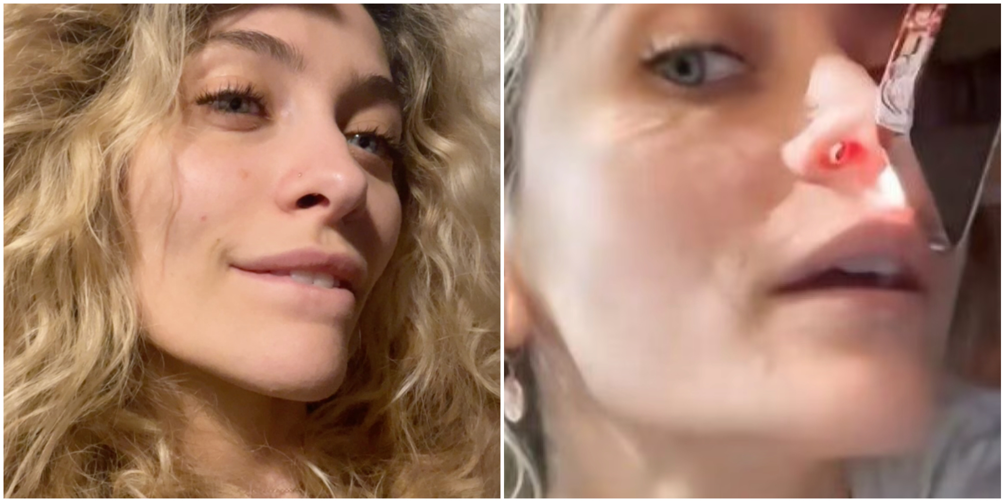Mostra il naso rovinato dall’abuso di droga e festeggia cinque anni senza alcol: la nuova vita di Paris Jackson, figlia del re del pop Michael – IL VIDEO
