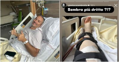 Copertina di “Operazione finita. Sembra più dritta?”: la foto postata da Zambrotta dopo l’intervento per risolvere il varismo