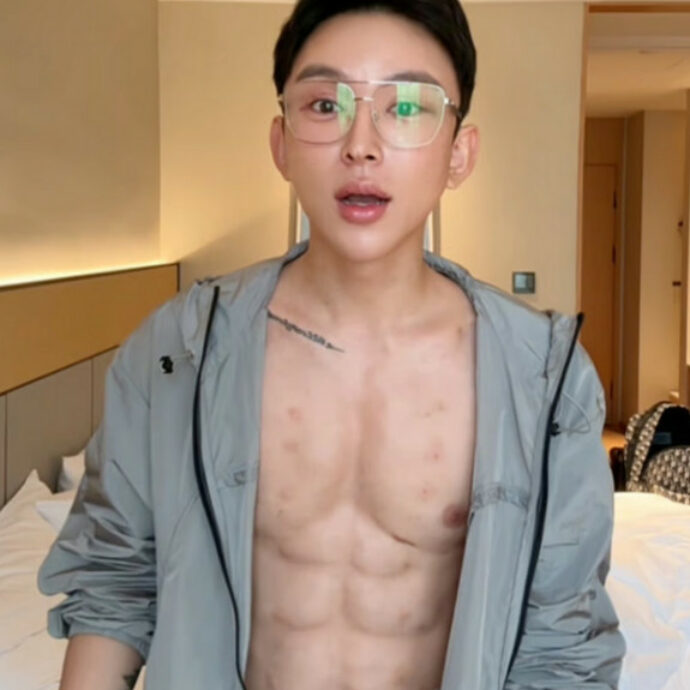 “Ho speso 500mila euro in filler per avere la ‘tartaruga’ senza sudare in palestra. Voglio entrare nel Guinnes iniettandomi 10 mila dosi”: la storia dell’influencer Andy Hao Tienan