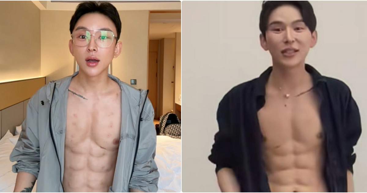 ho speso 500mila euro in filler per avere la 8216tartaruga8217 senza sudare in palestra voglio entrare nel guinnes iniettandomi 10 mila dosi la storia dell8217influencer andy hao tienan