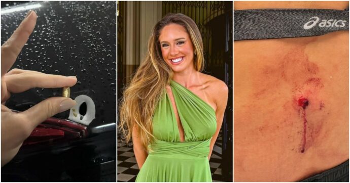 “Mi hanno sparato. Il proiettile è entrato nella mia schiena ma è uscito senza causare grossi danni”: la storia choc della pallavolista Julia Rocha Marques de Azevedo