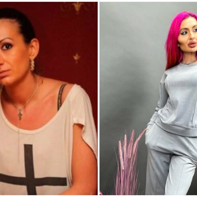 La donna con le guance più grandi al mondo stupisce i suoi fan: Anastasia Pokreshchuk pubblica una foto del suo volto prima della chirurgia estetica