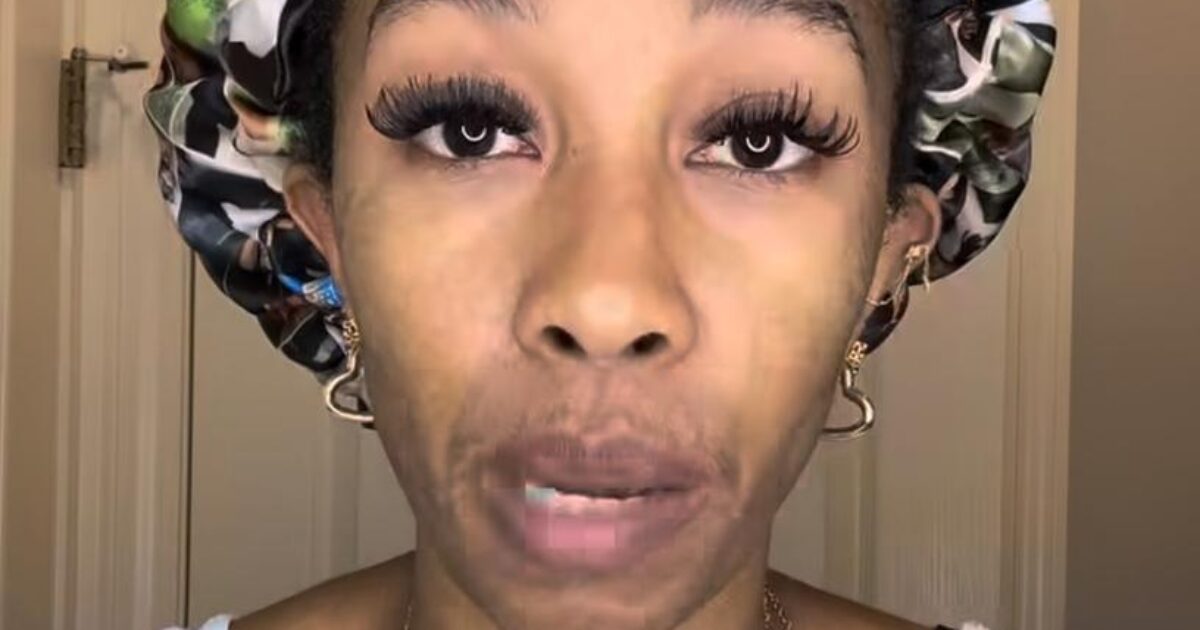 “Ho sempre pensato che i capelli cadono e poi ricrescono, ma sono disperata. Ho usato un farmaco anti-caduta e ora sono più calva di prima”: lo sfogo in lacrime di Maria Cribbs