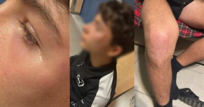 Copertina di Arbitro 15enne aggredito a Ginosa in una partita di Under 16: calci e pugni per un’espulsione