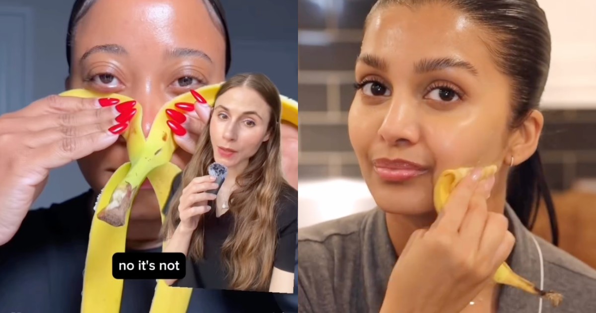 Spalmarsi una buccia di banana in faccia per avere un effetto botox immediato (e a costo zero o quasi): il nuovo trend spopola su TikTok, ecco come funziona e cosa c’è di vero
