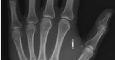 Copertina di “Mi sono fatto impiantare un chip nella mano per fare trucchi di magia ma ho dimenticato la password”: la storia del mago-scienziato Zi Teng Wang